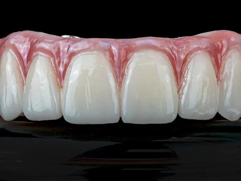 Monolithic Zirconia All-on-X